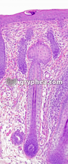 Poil en formation CL x150 - gryphea.org